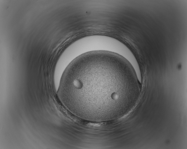 X0000116120170200912141053