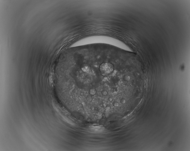 X0000116120175200912141053