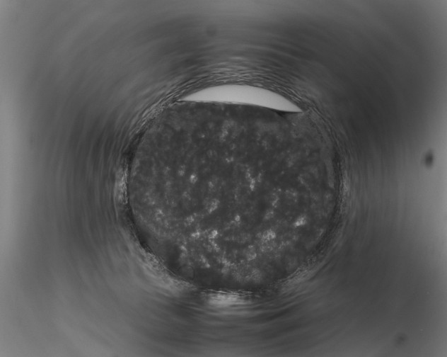 X0000116120177200912141054