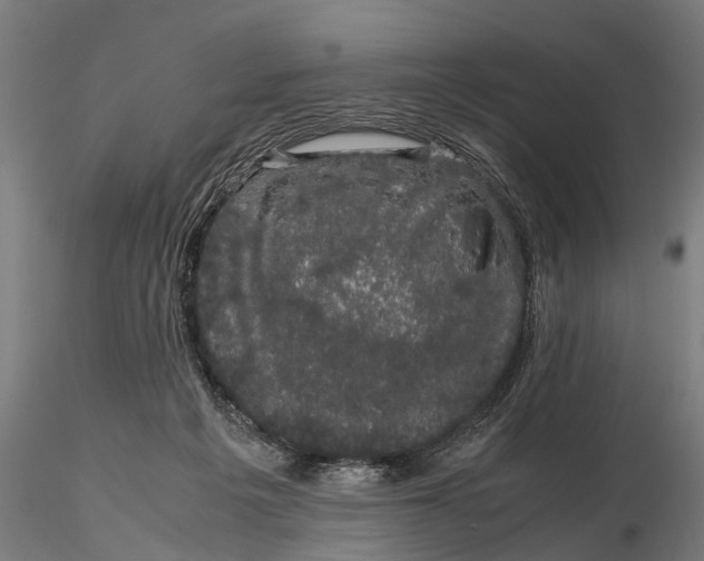 X0000116120217200912141053