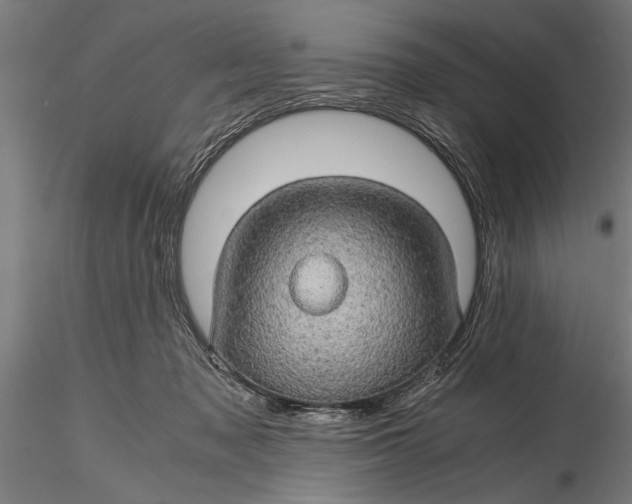 X0000116120317200912141051