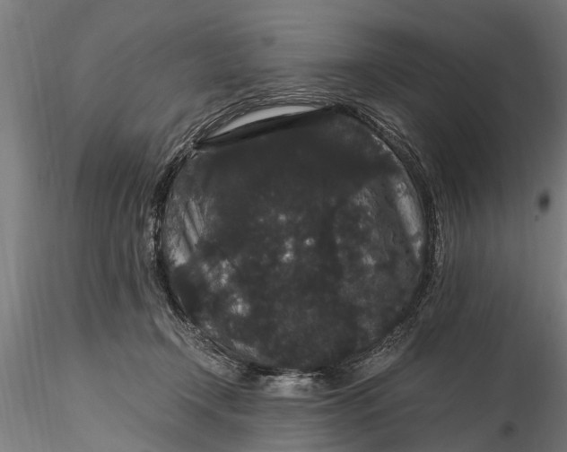 X0000116120366200912141051