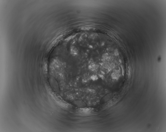 X0000116120375200912141051