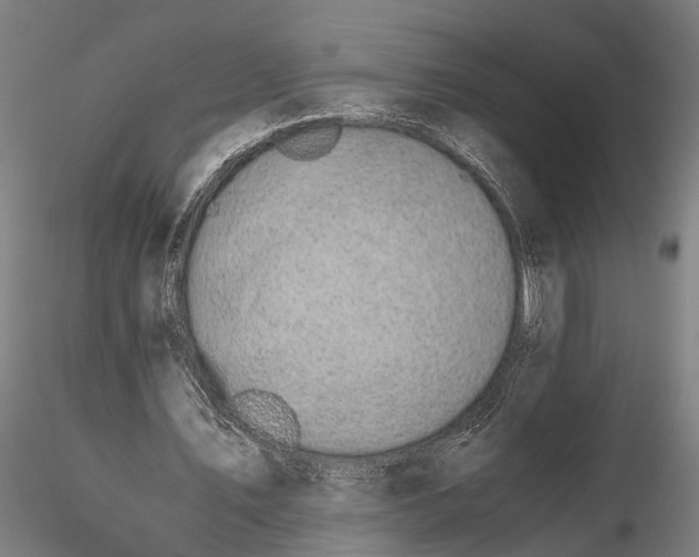 X0000116120579200912141047