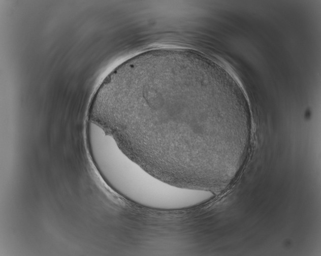 X0000116121195200912141038