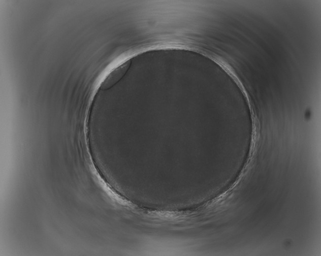 X0000116121197200912141038