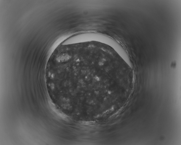 X0000116120147200912211701