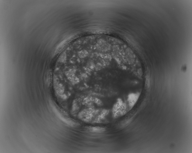 X0000116120165200912211701
