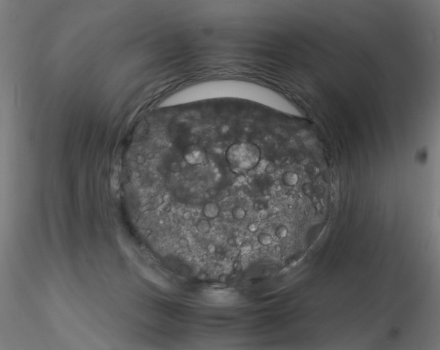 X0000116120175200912211701