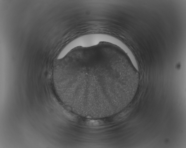 X0000116120277200912211700