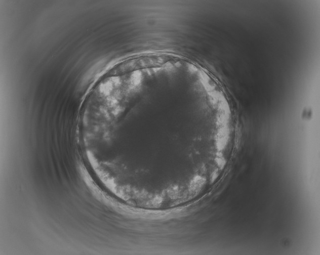 X0000116120002201001041000