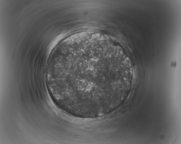 X0000116120003201001041000