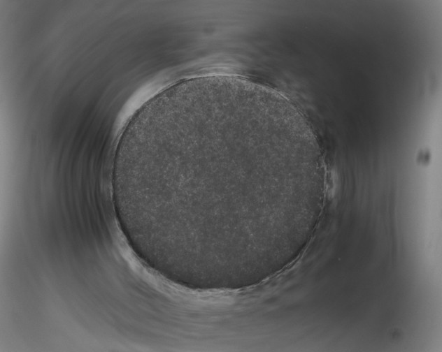 X0000116120004201001041000