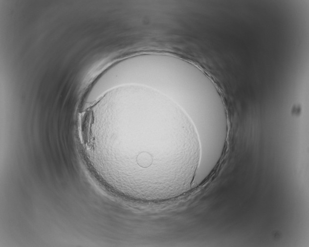 X0000116120005201001041000