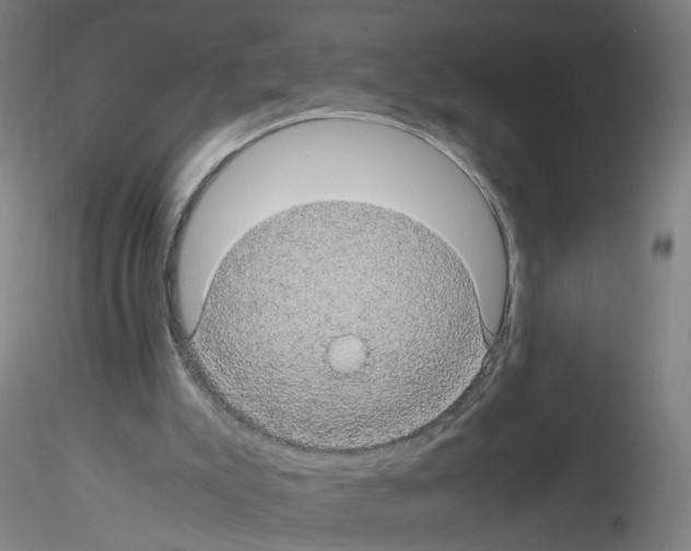 X0000116120007201001041000