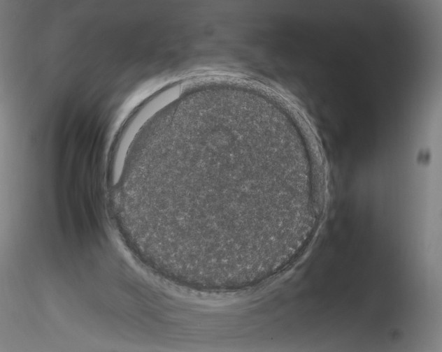 X0000116120008201001041000
