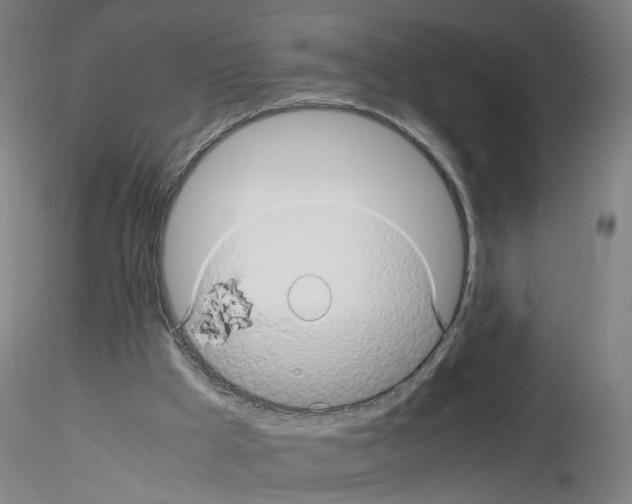 X0000116120009201001041000