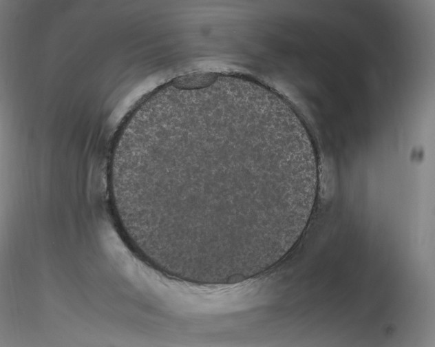 X0000116120015201001041000