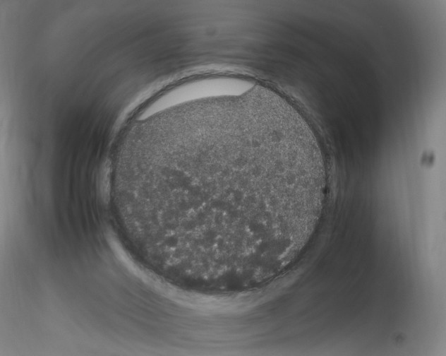 X0000116120016201001041000