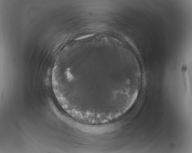 X0000116120018201001041000