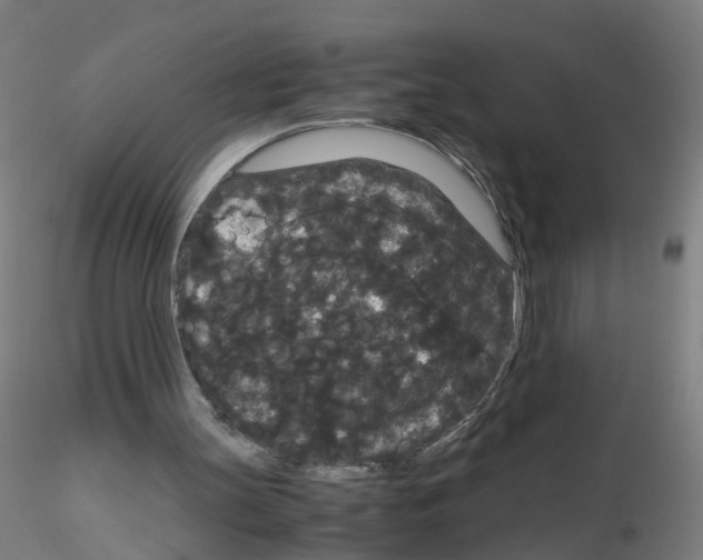 X0000116120147201001040957