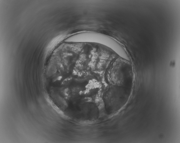 X0000116120149201001040957