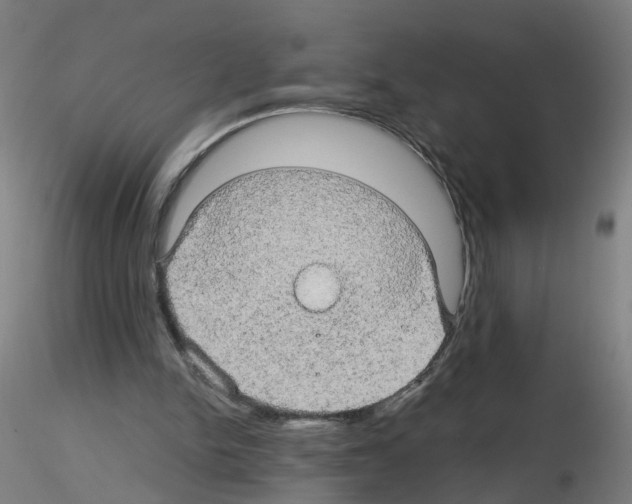 X0000116120150201001040957