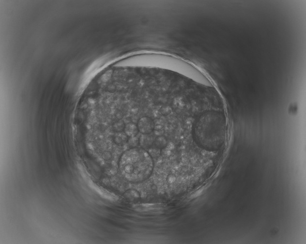 X0000116120151201001040957