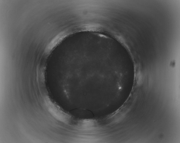 X0000116120154201001040957