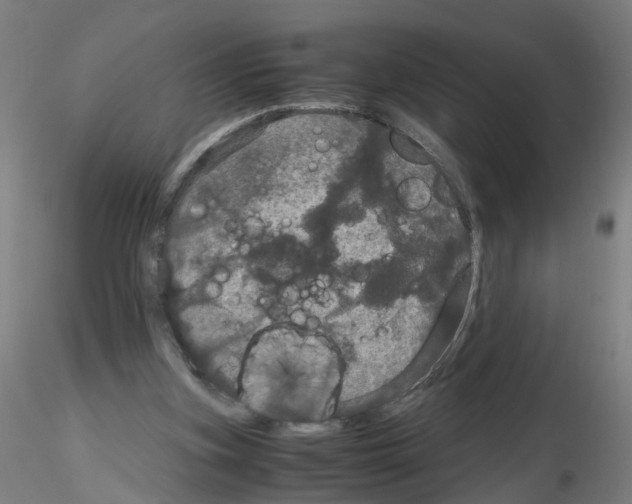 X0000116120155201001040957