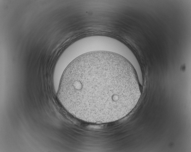 X0000116120170201001040958