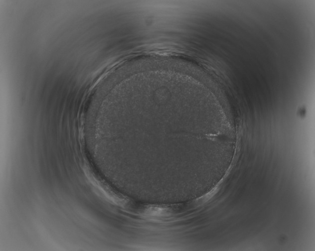 X0000116120174201001040958