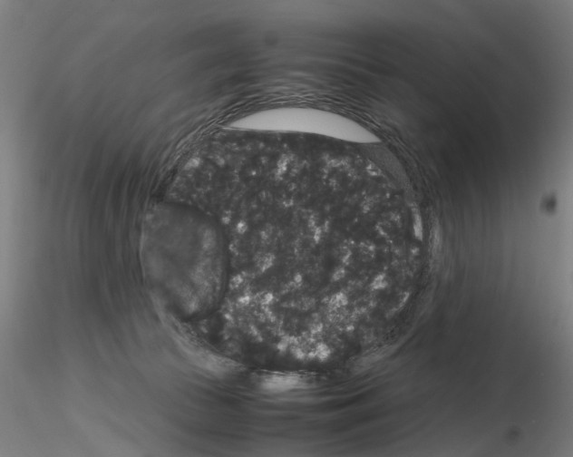 X0000116120177201001040958
