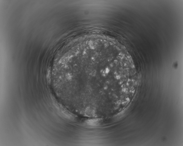 X0000116120178201001040958