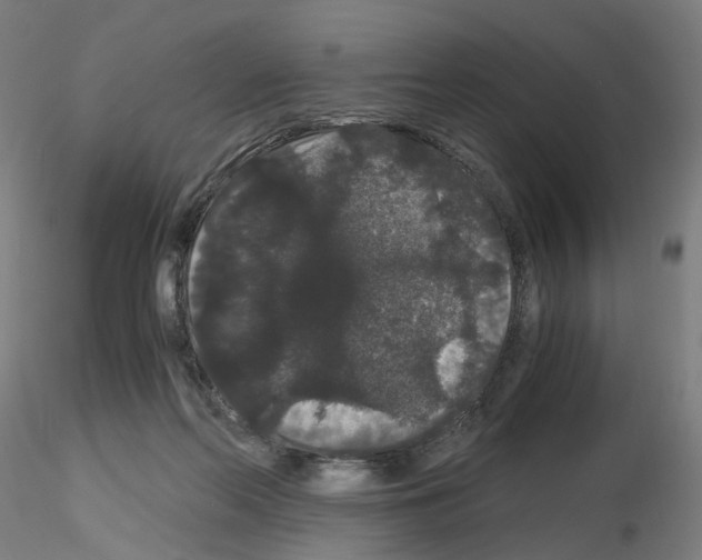 X0000116120214201001040957