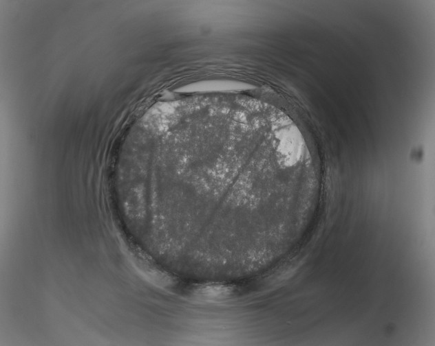 X0000116120217201001040957