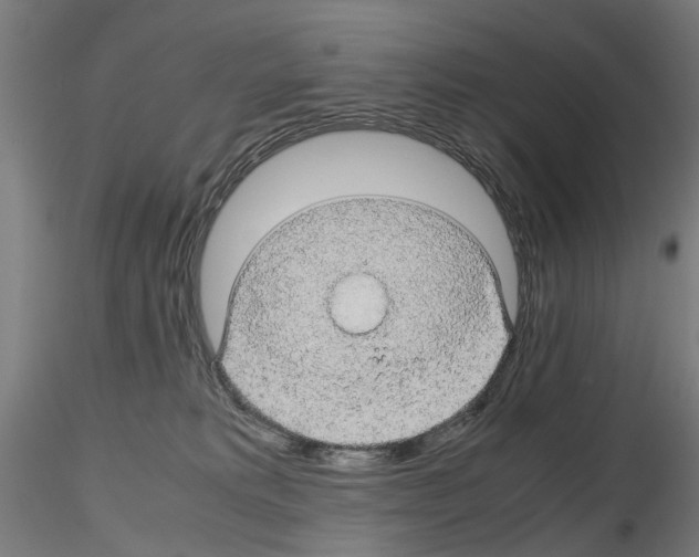 X0000116120229201001040957