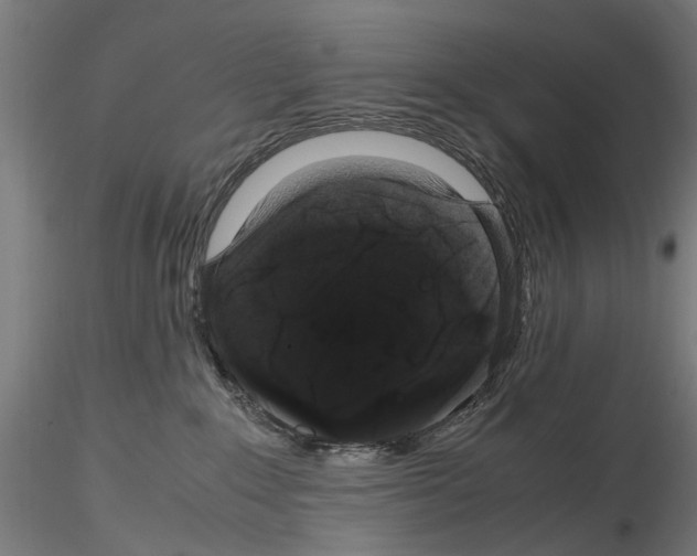 X0000116120235201001040957
