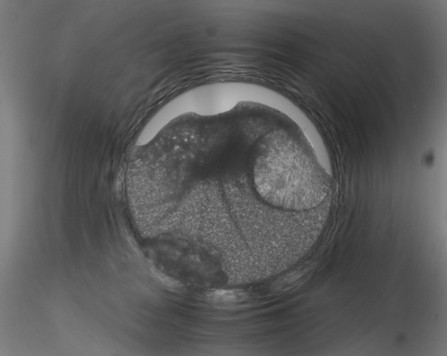 X0000116120277201001040957