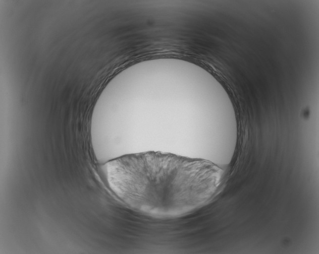 X0000116120281201001040957