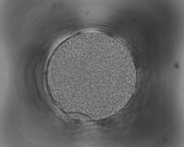 X0000116120289201001040956