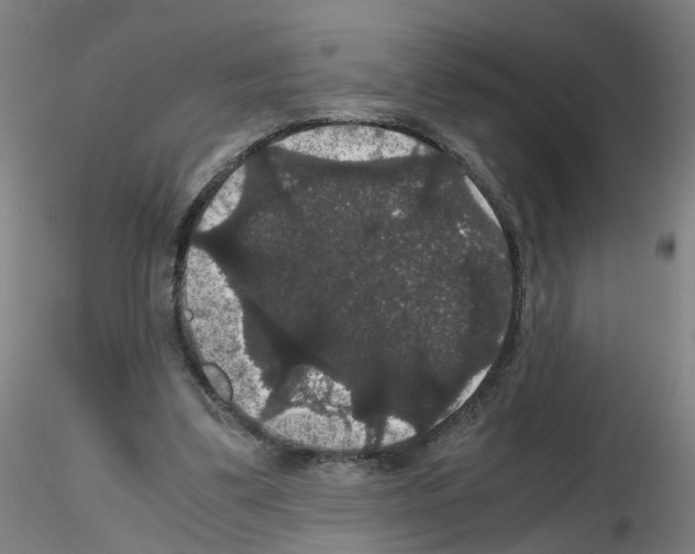 X0000116120299201001040956