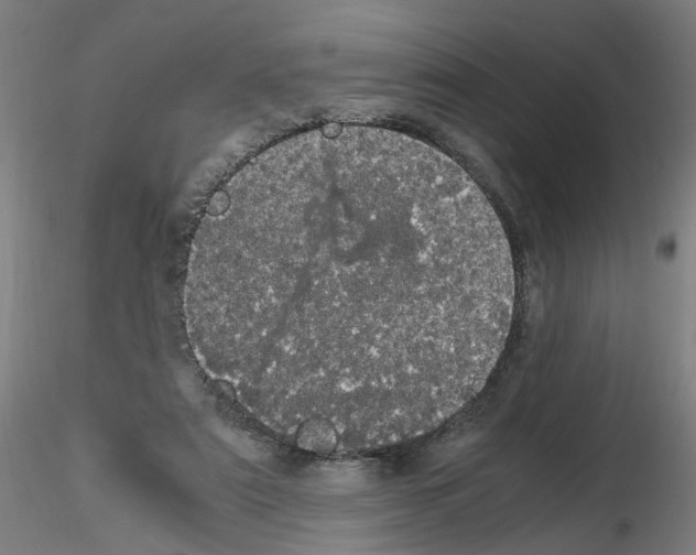 X0000116120307201001040956