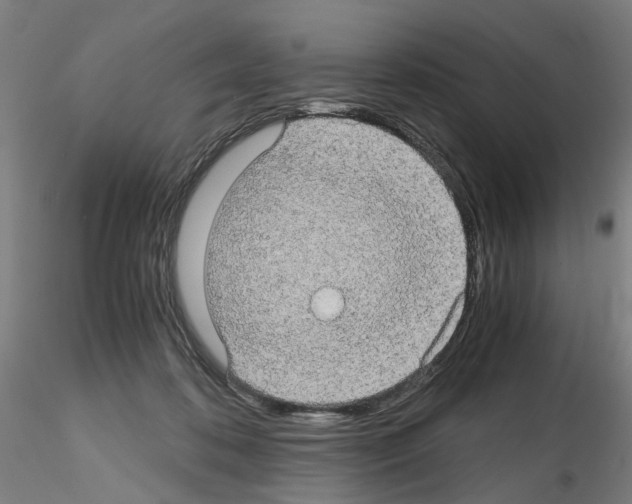 X0000116120316201001040956