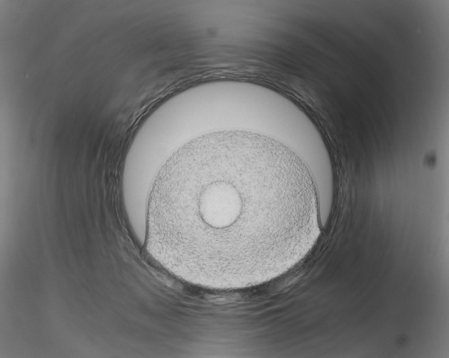 X0000116120317201001040956