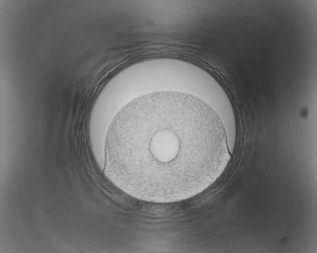 X0000116120325201001040956