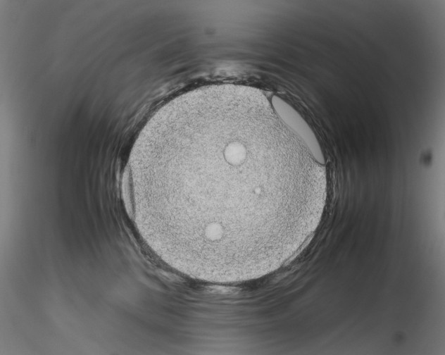 X0000116120328201001040955