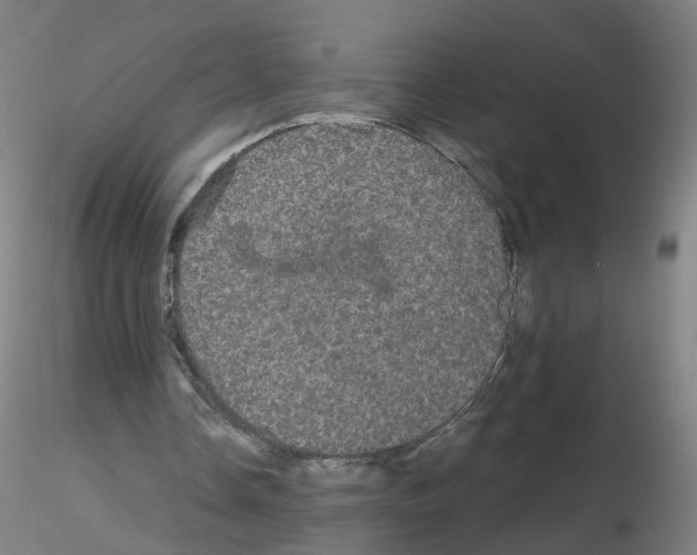 X0000116120338201001040955