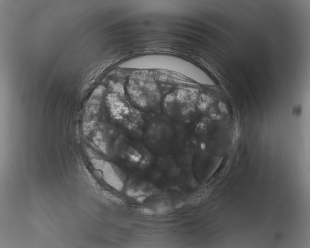 X0000116120353201001040955