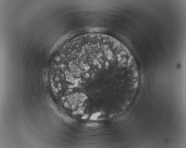 X0000116120357201001040955